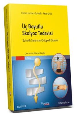 Üç Boyutlu Skolyoz Tedavisi