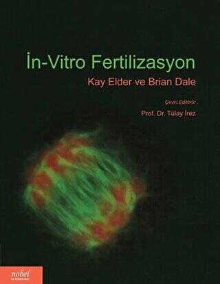 İn Vitro Fertilizasyon