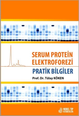 Serum Protein Elektroforezi Pratik Bilgiler