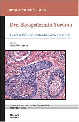 Deri Biyopsilerinin Yorumu Derinin Primer Lenfoid Dışı Neoplazileri