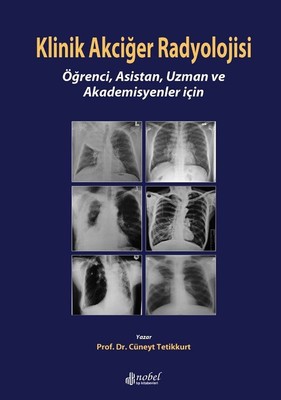 Klinik Akciğer Radyolojisi Öğrenci Asistan Uzman ve Akademisyenler için