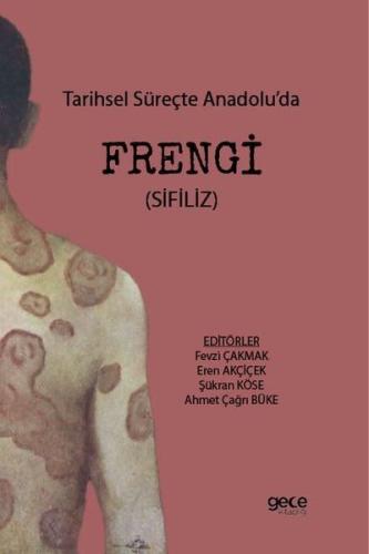Tarihsel Süreçte Anadolu da Frengi