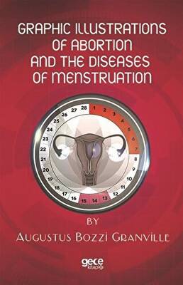 Graphic Illustrations Of Abortion And The Diseases Of Menstruation