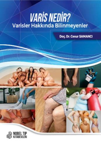 Varis Nedir Varisler Hakkında Bilinmeyenler