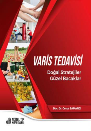 Varis Tedavisi Doğal Stratejiler Güzel Bacaklar
