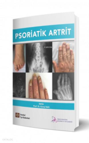 Psoriatik Artrit