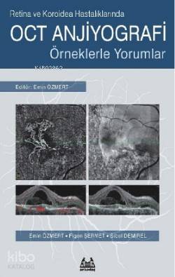 Retina ve Koroidea Hastalıklarında OCT Anjiyografi Örneklerle Yorumlar