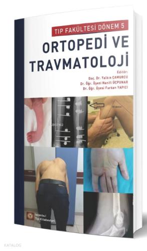 Ortopedi ve Travmatoloji
