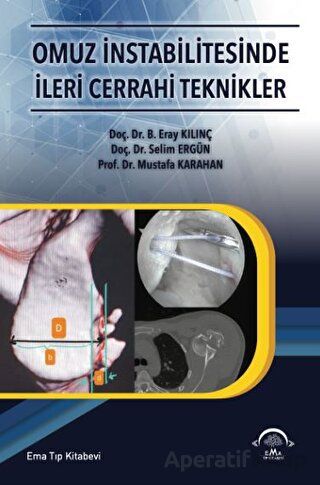 Omuz İntabilitesinde İleri Cerrahi Teknikler